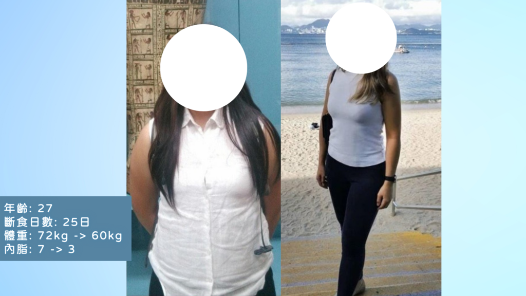 27歲女士透過醫學斷食後減了12kg及4格內臟脂肪